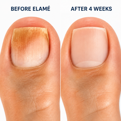 Elamé™ Nail Repair Patches